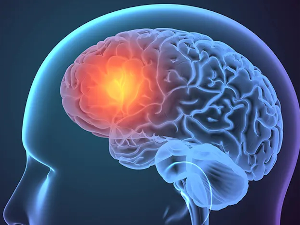 Beyin Pili Faydaları ve Beyin Pili Ameliyatı